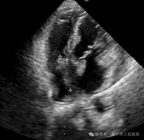 https://mmecoa.qpic.cn/sz_mmecoa_png/nergRibqqrNgq2Lpt1398dC6txNhaD8ya81KGWV9jbeI4KicFl3Aedekf0tHSSlibcuiauJlyial5HO8Q5RlnADt4kA/640?wx_fmt=png