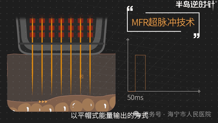 https://mmecoa.qpic.cn/sz_mmecoa_png/nergRibqqrNiawNAdGhZc5jQnX9YiccTZ29mFgL5DiaDQ5o9D9vWFUiadKIiadicGydtkfPJLESHGK3iaDNMia5S9hZUMicQ/640?wx_fmt=png&tp=wxpic&wxfrom=10005&wx_lazy=1 圖片2.png